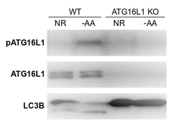 Western blot - Anti-ATG16L1 (phospho S278) antibody [EPR19016] (AB195242)