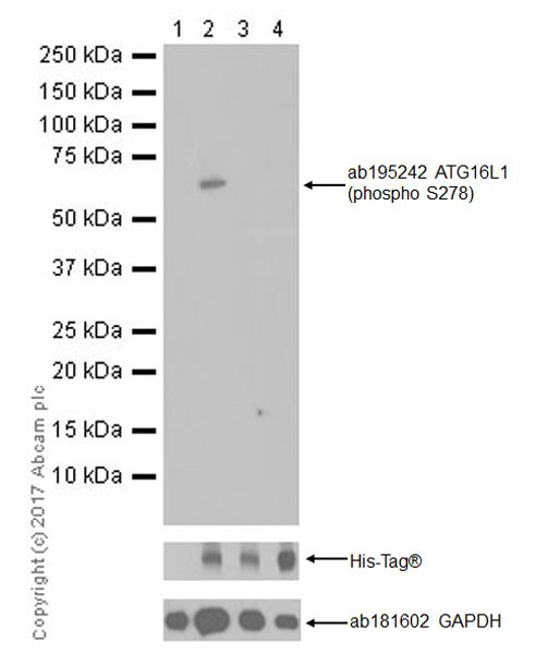Western blot - Anti-ATG16L1 (phospho S278) antibody [EPR19016] (ab195242), expandable thumbnail