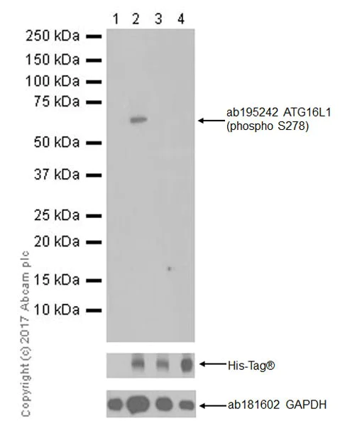 Western blot - Anti-ATG16L1 (phospho S278) antibody [EPR19016] (AB195242)