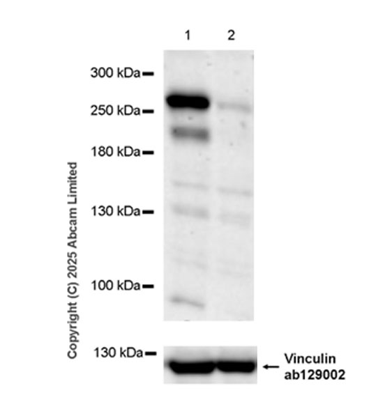 Western blot - Anti-ATG2B antibody [EPR29648-33] (AB323620), expandable thumbnail
