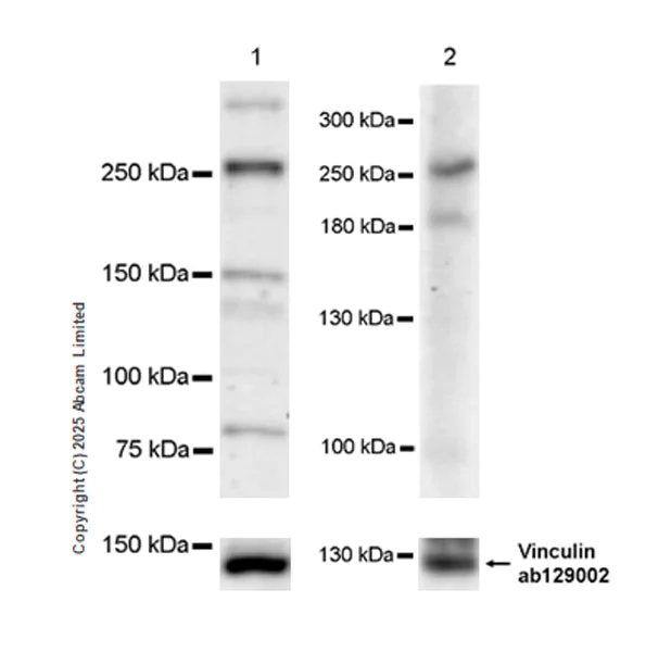 Western blot - Anti-ATG2B antibody [EPR29648-33] (AB323620)