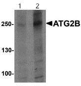 Western blot - Anti-ATG2B antibody - N-terminal (AB189934)
