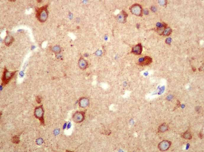 Immunohistochemistry (Formalin/PFA-fixed paraffin-embedded sections) - Anti-ATG4A antibody [EPR4122] (AB108322), expandable thumbnail