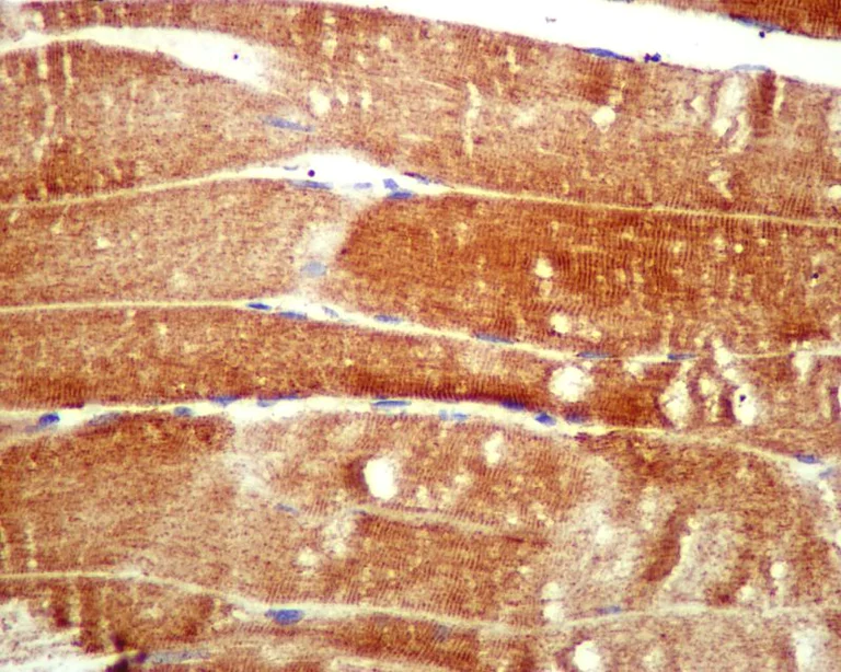 Immunohistochemistry (Formalin/PFA-fixed paraffin-embedded sections) - Anti-ATG4A antibody [EPR4122] - BSA and Azide free (AB247630)