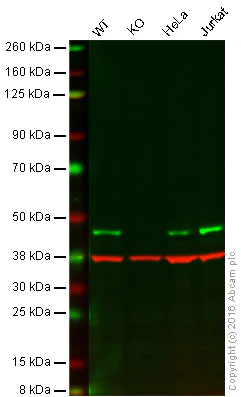 Western blot - Anti-ATG4B antibody [EPR16572] (AB199537)