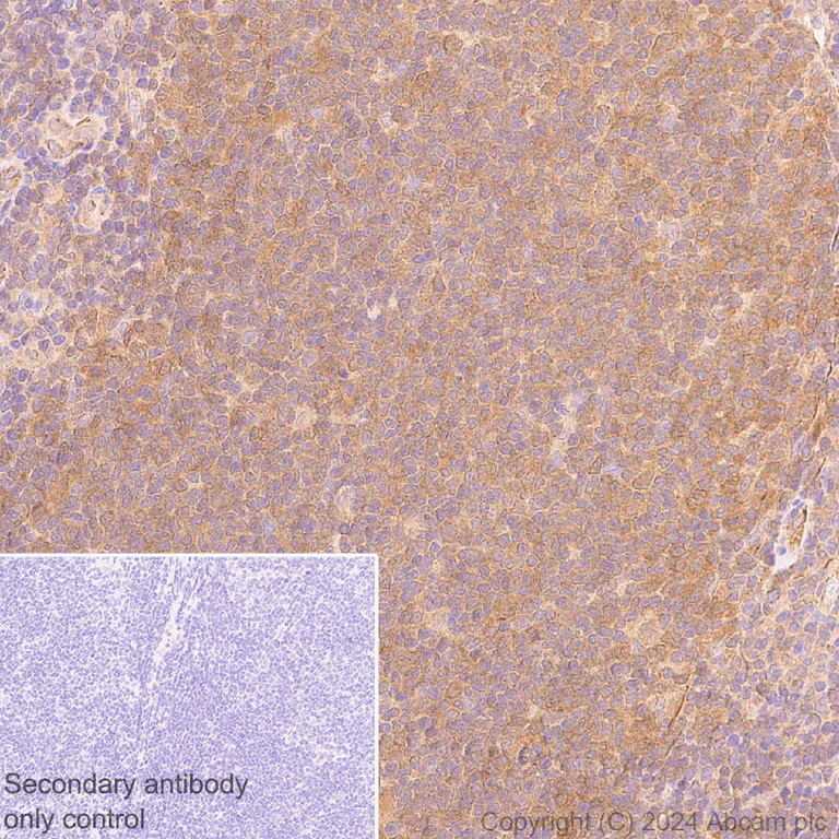 Immunohistochemistry (Formalin/PFA-fixed paraffin-embedded sections) - Anti-ATG4B antibody [EPR28756-91] (AB317821)
