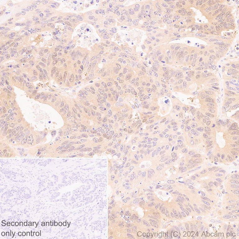 Immunohistochemistry (Formalin/PFA-fixed paraffin-embedded sections) - Anti-ATG4B antibody [EPR28756-91] (AB317821)