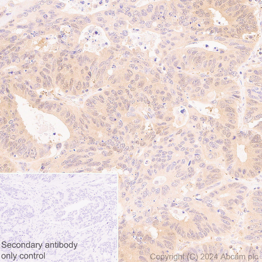 Immunohistochemistry (Formalin/PFA-fixed paraffin-embedded sections) - Anti-ATG4B antibody [EPR28756-91] - BSA and Azide free (AB317822), expandable thumbnail