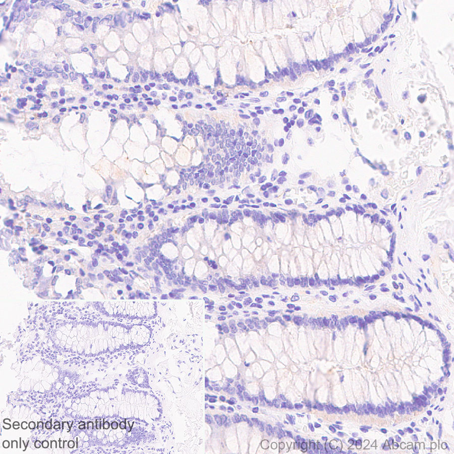 Immunohistochemistry (Formalin/PFA-fixed paraffin-embedded sections) - Anti-ATG4B antibody [EPR28756-91] - BSA and Azide free (AB317822), expandable thumbnail