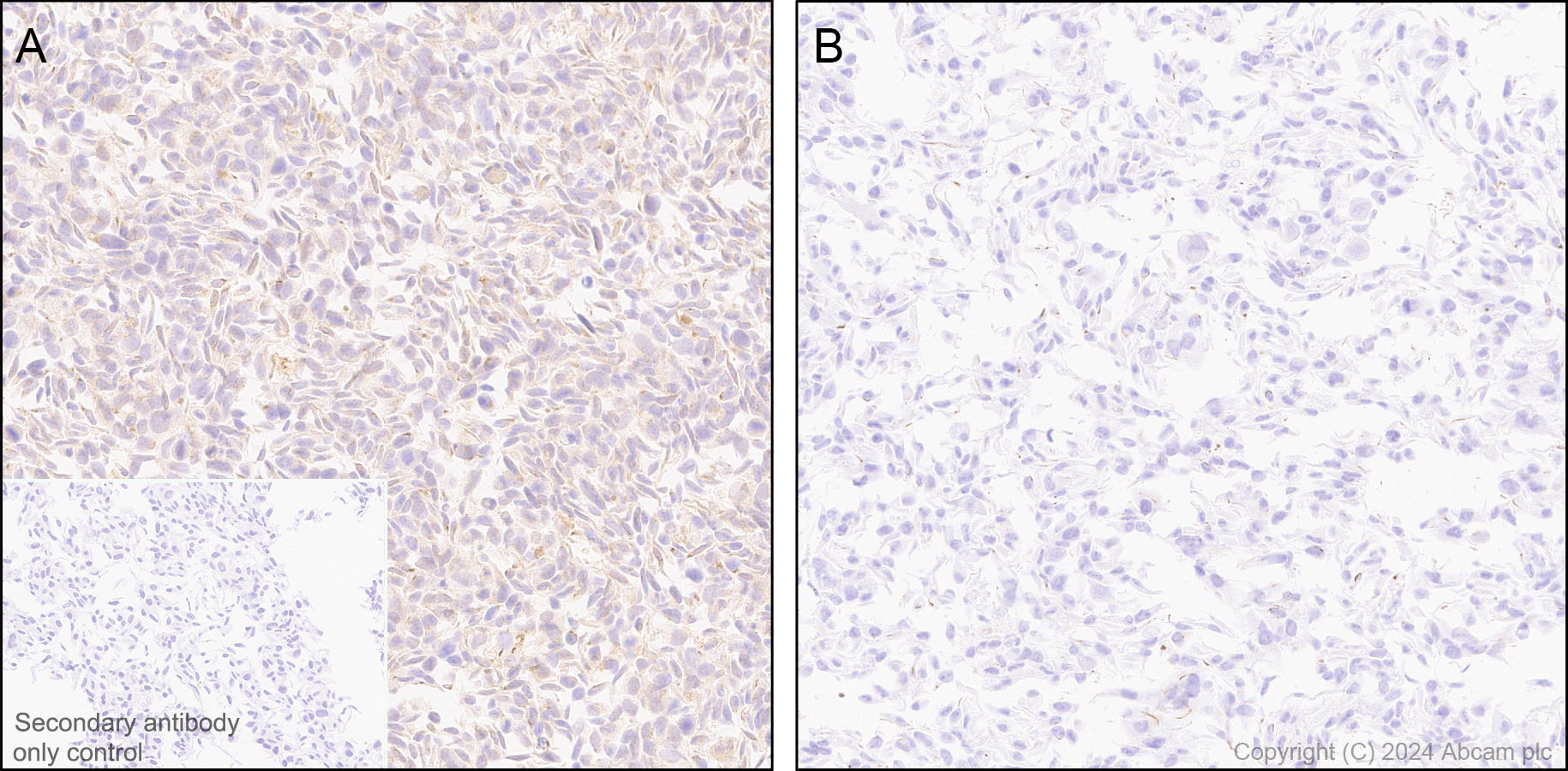 Immunohistochemistry (Formalin/PFA-fixed paraffin-embedded sections) - Anti-ATG4B antibody [EPR28756-91] - BSA and Azide free (AB317822), expandable thumbnail