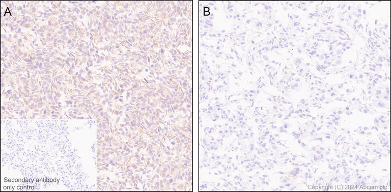 Immunohistochemistry (Formalin/PFA-fixed paraffin-embedded sections) - Anti-ATG4B antibody [EPR28756-91] - BSA and Azide free (AB317822)