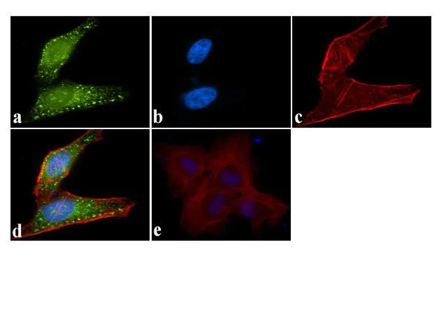 Immunocytochemistry/ Immunofluorescence - Anti-ATG4B antibody [RP23040125] (AB308052)
