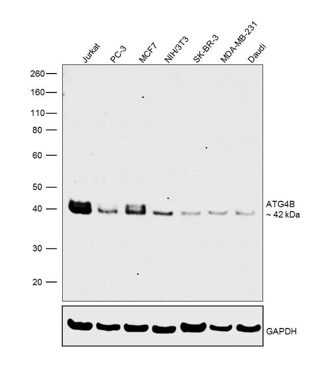 Western blot - Anti-ATG4B antibody [RP23040125] (AB308052)