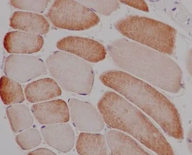 Immunohistochemistry (Formalin/PFA-fixed paraffin-embedded sections) - Anti-ATG4C antibody [EPR15001] (AB183516)