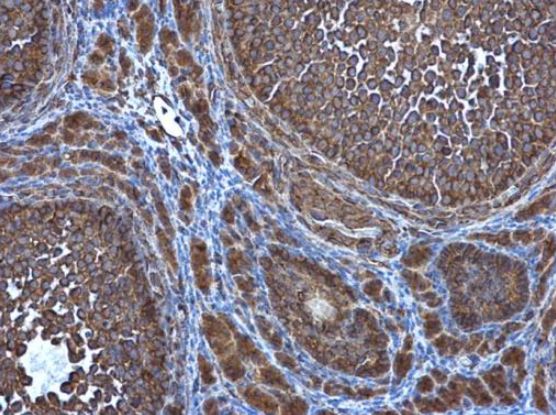 Immunohistochemistry (Formalin/PFA-fixed paraffin-embedded sections) - Anti-ATG4D antibody (AB137621), expandable thumbnail