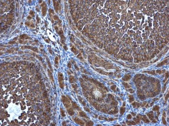 Immunohistochemistry (Formalin/PFA-fixed paraffin-embedded sections) - Anti-ATG4D antibody (AB137621)