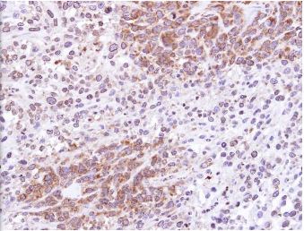 Immunohistochemistry (Formalin/PFA-fixed paraffin-embedded sections) - Anti-ATG4D antibody (AB137621), expandable thumbnail
