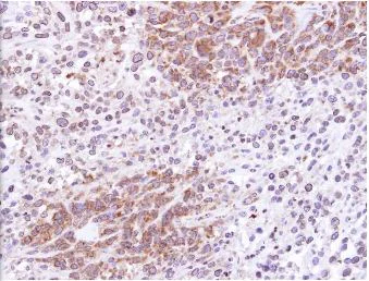 Immunohistochemistry (Formalin/PFA-fixed paraffin-embedded sections) - Anti-ATG4D antibody (AB137621)