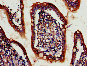 Immunohistochemistry (Formalin/PFA-fixed paraffin-embedded sections) - Anti-ATG4D antibody (AB237751), expandable thumbnail