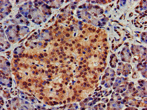 Immunohistochemistry (Formalin/PFA-fixed paraffin-embedded sections) - Anti-ATG4D antibody (AB237751), expandable thumbnail