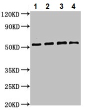 Western blot - Anti-ATG4D antibody (AB237751), expandable thumbnail