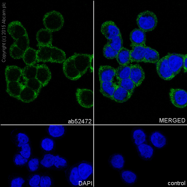 Immunocytochemistry/ Immunofluorescence - Anti-ATG7 antibody [EP1759Y] (ab52472), expandable thumbnail
