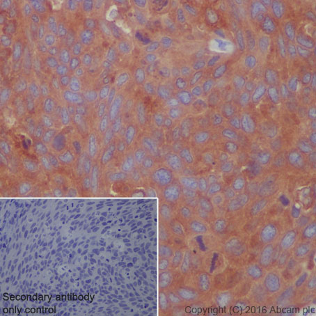 Immunohistochemistry (Formalin/PFA-fixed paraffin-embedded sections) - Anti-ATG7 antibody [EP1759Y] (ab52472), expandable thumbnail