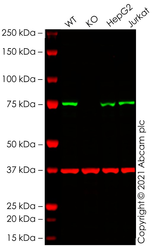 Western blot - Anti-ATG7 antibody [EP1759Y] (AB52472), expandable thumbnail