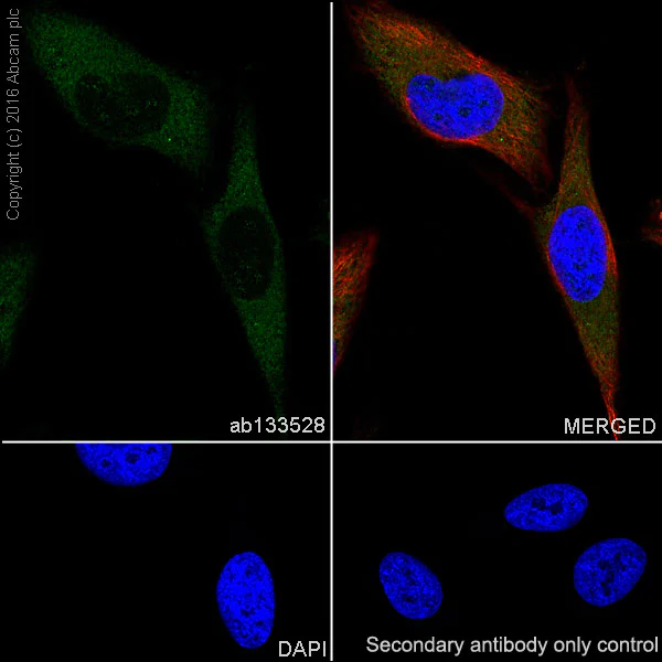 Immunocytochemistry/ Immunofluorescence - Anti-ATG7 antibody [EPR6251] (AB133528)