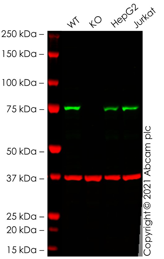 Western blot - Anti-ATG7 antibody [EPR6251] (AB133528), expandable thumbnail