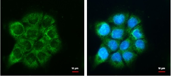 Immunocytochemistry/ Immunofluorescence - Anti-ATG9A antibody - C-terminal (AB229334)