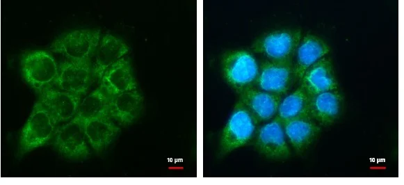 Immunocytochemistry/ Immunofluorescence - Anti-ATG9A antibody - C-terminal (AB229334)