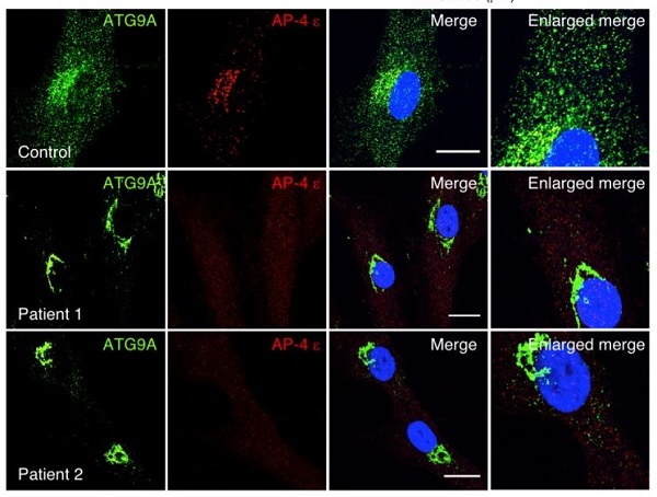 Immunocytochemistry/ Immunofluorescence - Anti-ATG9A antibody [EPR2450(2)] (AB108338), expandable thumbnail