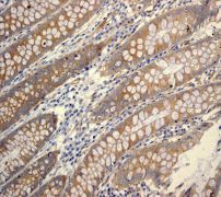 Immunohistochemistry (Formalin/PFA-fixed paraffin-embedded sections) - Anti-ATG9A antibody [EPR2450(2)] (ab108338), expandable thumbnail