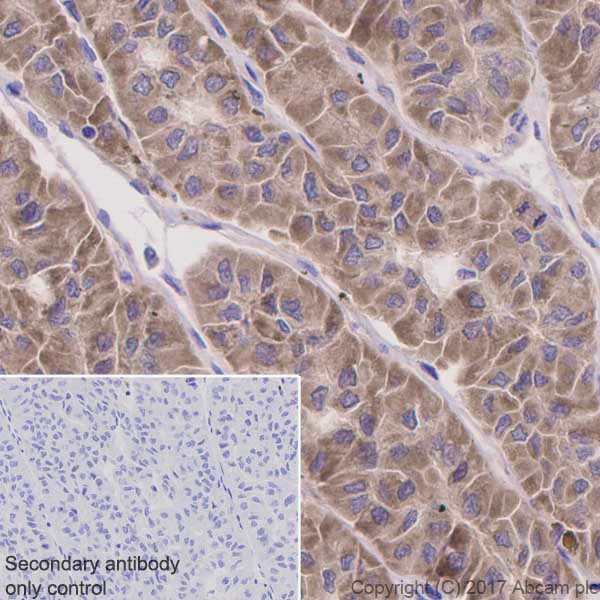 Immunohistochemistry (Formalin/PFA-fixed paraffin-embedded sections) - Anti-ATG9A antibody [EPR2450(2)] (AB108338)