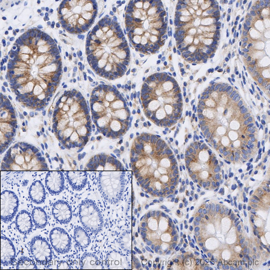 Immunohistochemistry (Formalin/PFA-fixed paraffin-embedded sections) - Anti-ATG9A antibody [EPR2450(2)] (AB108338)