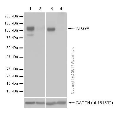 Western blot - Anti-ATG9A antibody [EPR2450(2)] (ab108338), expandable thumbnail