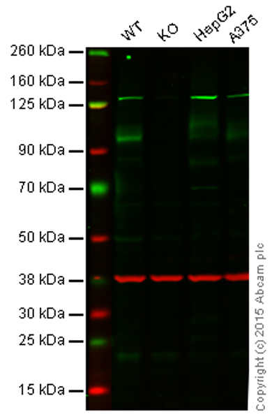 Western blot - Anti-ATG9A antibody [EPR2450(2)] (AB108338), expandable thumbnail