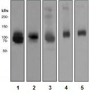 Western blot - Anti-ATG9A antibody [EPR2450(2)] (ab108338), expandable thumbnail