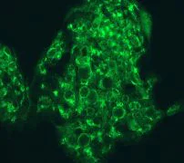 Immunocytochemistry/ Immunofluorescence - Anti-ATG9A antibody [EPR2450(2)] - BSA and Azide free (AB223528)
