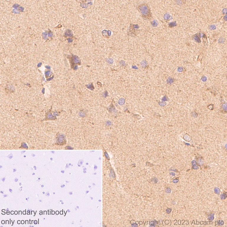 Immunohistochemistry (Formalin/PFA-fixed paraffin-embedded sections) - Anti-ATG9A antibody [EPR2450(2)] - Mouse IgG1 (Chimeric) (AB309518)