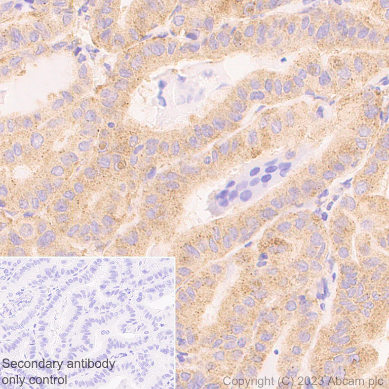 Immunohistochemistry (Formalin/PFA-fixed paraffin-embedded sections) - Anti-ATG9A antibody [EPR2450(2)] - Mouse IgG1 (Chimeric) (AB309518)