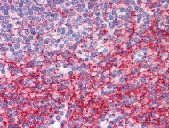 Immunohistochemistry (Formalin/PFA-fixed paraffin-embedded sections) - Anti-ATG9B antibody (AB117591)