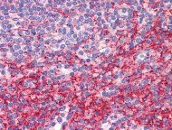Immunohistochemistry (Formalin/PFA-fixed paraffin-embedded sections) - Anti-ATG9B antibody (AB117591)