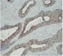 Immunohistochemistry (Formalin/PFA-fixed paraffin-embedded sections) - Anti-ATIC antibody [F38 P7 H9] (AB33520)