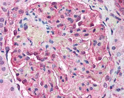 Immunohistochemistry (Formalin/PFA-fixed paraffin-embedded sections) - Anti-ATM antibody [2C1 (1A1)] - BSA and Azide free (AB78)