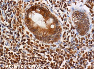 Immunohistochemistry (Formalin/PFA-fixed paraffin-embedded sections) - Anti-ATM antibody [2C1 (1A1)] - BSA and Azide free (AB78)
