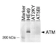 Western blot - Anti-ATM antibody [2C1 (1A1)] - BSA and Azide free (AB78)
