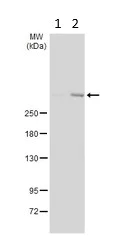 Western blot - Anti-ATM antibody [2C1 (1A1)] - BSA and Azide free (AB78)