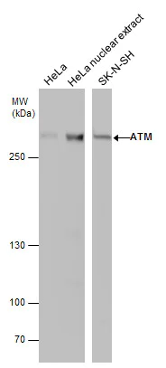 Western blot - Anti-ATM antibody [2C1 (1A1)] - BSA and Azide free (AB78)